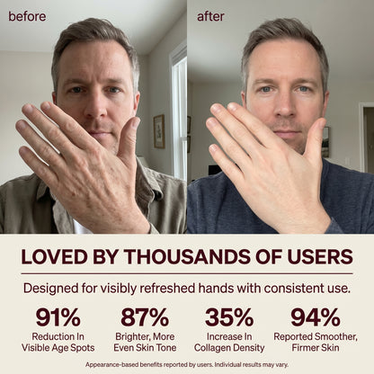 Hand Restore Gloves